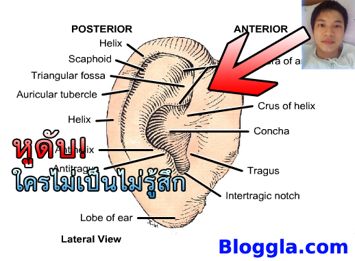 วันที่ผมป่วย (อีกครั้ง) หูดับ